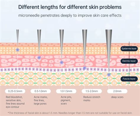 Factors Influencing Derma Stamp Depth Selection