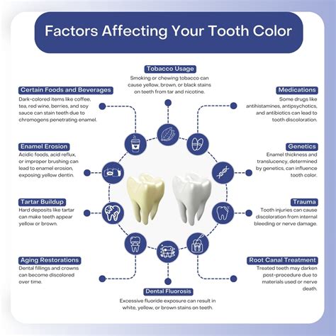 Factors Influencing Your Whitening Session