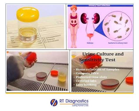 Factors to Consider When Choosing a Urine CS Test Provider