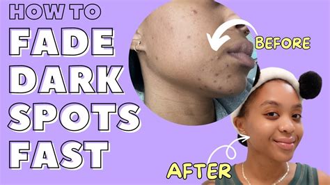 Fade Dark Spots: Fast, Effective Solutions