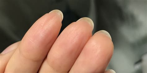 Unleashing the Bold & Beautiful: The Ultimate Guide to Subdermal Fake Nails