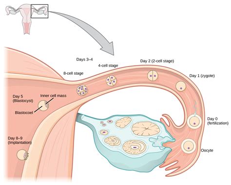 Cureus A Live 13 Weeks Ruptured Ectopic Pregnancy A