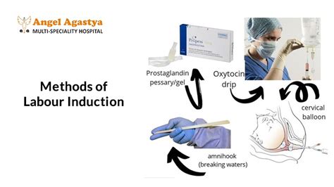 Fast Labor Induction: Methods & What to Expect.