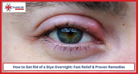Fast Red Eye Relief: Proven Remedies