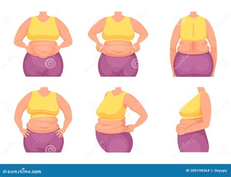 Fat Figure Anatomy
