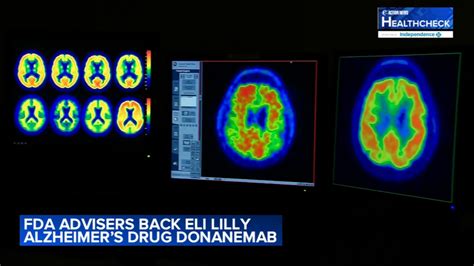 Fda Approves Alzheimer Drug