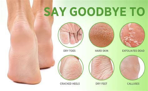 Reveal Summer-Ready Feet: The Relaxing and Cleansing Experience of Dead Skin Removal