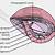 Female Inguinal Hernia Anatomy