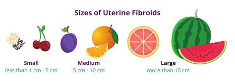 Fibroid Sizes Chart