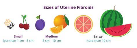 Fibroid Tumor Size Chart