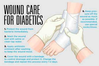 First Steps on How To Treat Diabetes Wound Immediately