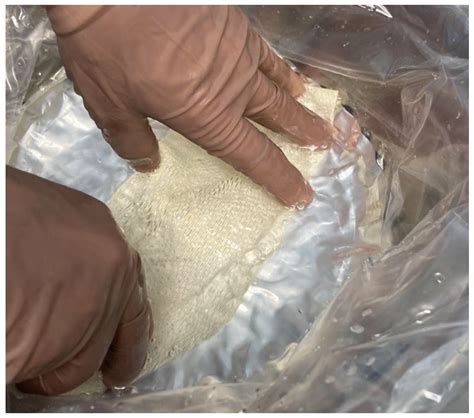 Transforming Lives: The Heart-Warming Before and After of Fish Skin Graft Surgery