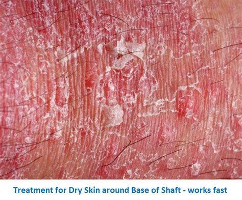 Ditch the Discomfort and Get Smoother, Healthier Skin Down There