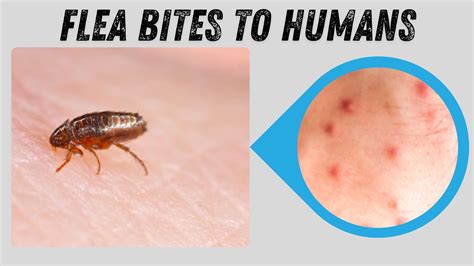 Flea Bits