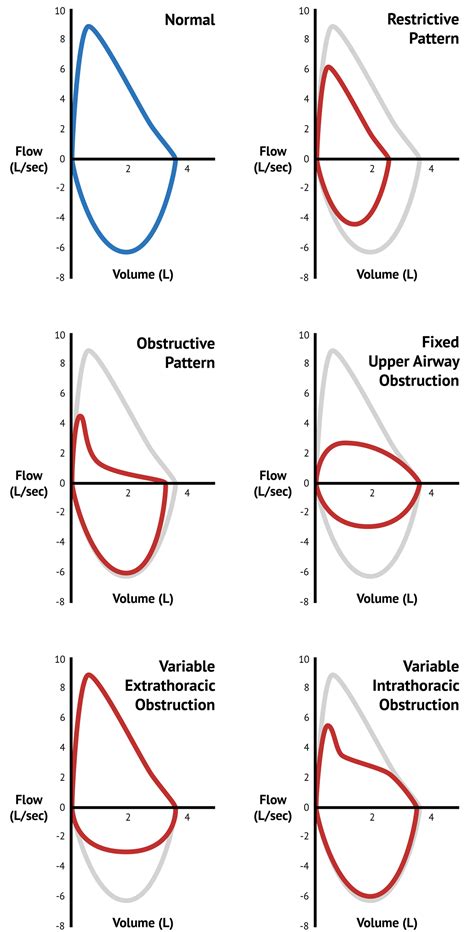 Flow Volume Loop Patterns