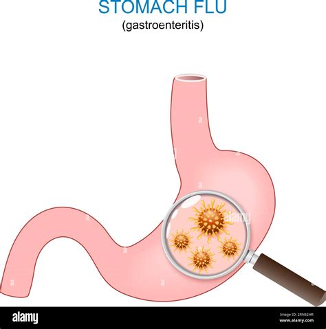 Flu Stomach