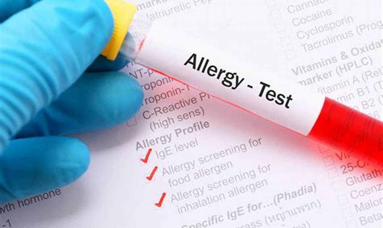 Food allergy testing in infants