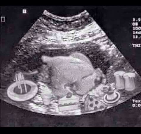 Food Baby Ultrasound Meme