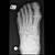 Foot Bones X Ray