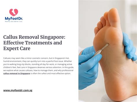 Foot Callus Removal: Complete Guide