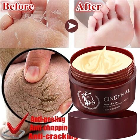 Step Up Your Skincare Routine with Our Exfoliating Foot Cream - Say Goodbye to Dead Skin for Good!