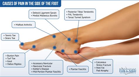 Foot Pain Chart Inside