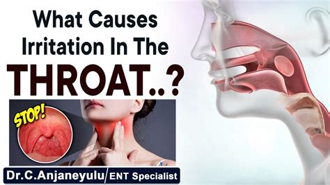 Foreign Body or Irritation