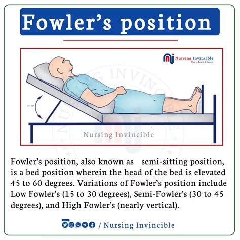 10-Word SEO Title: Understanding Fowler’s Position – A Complete Definition Guide