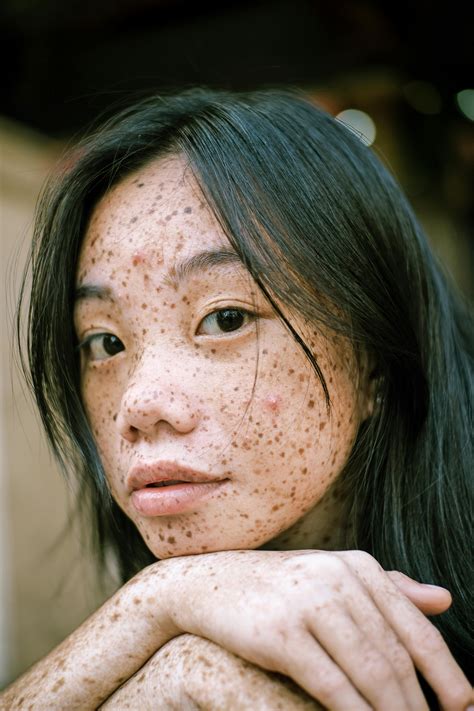 Unraveling the Beauty of Freckles on Asian Skin: A Journey into Unique Complexions
