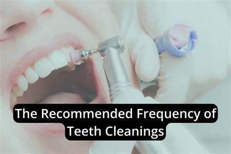 Frequency of teeth cleanings