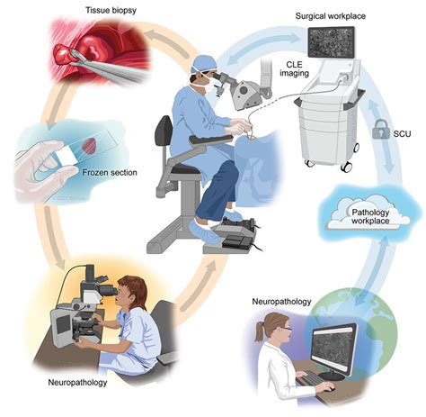 Frozen Section Analysis Test and interpretation
