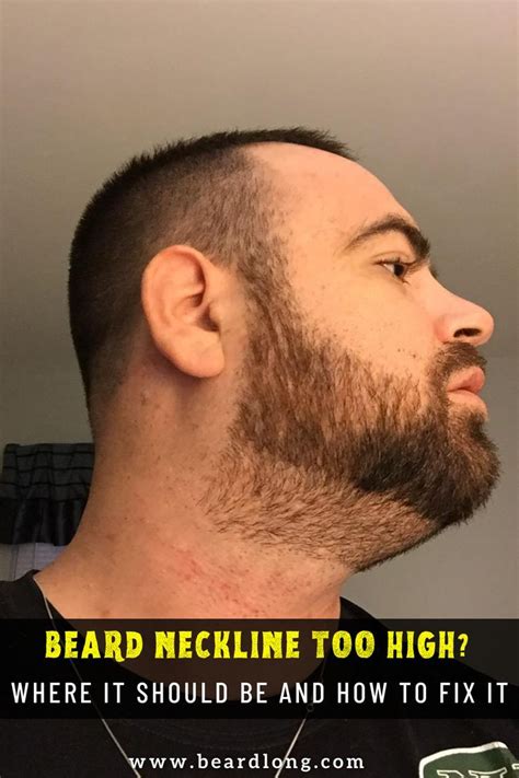 Full Beard Neckline Or Not