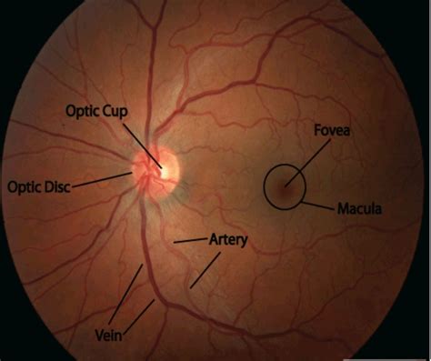 Fundus Examination