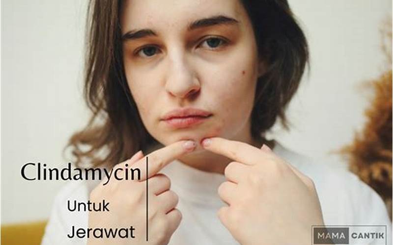 Fungsi Clindamycin Untuk Jerawat