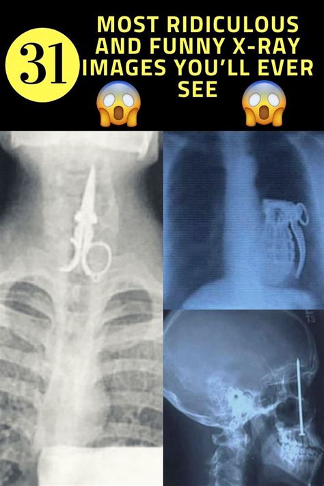 Funny Images Xray