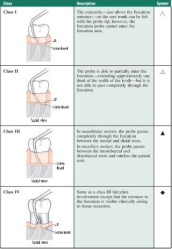 Furcation Charting