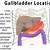 Gallbladder Pain Location Diagram