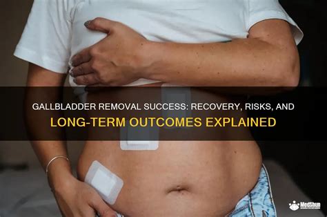 Gallbladder Removal: Recovery, Risks & Options.