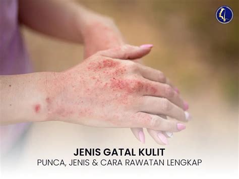 Gambar Kulit Gatal