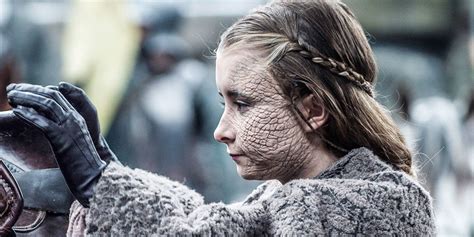 The Tainted Touch: Game of Thrones' Greyscale Disease and Its Menacing Grip on Westeros