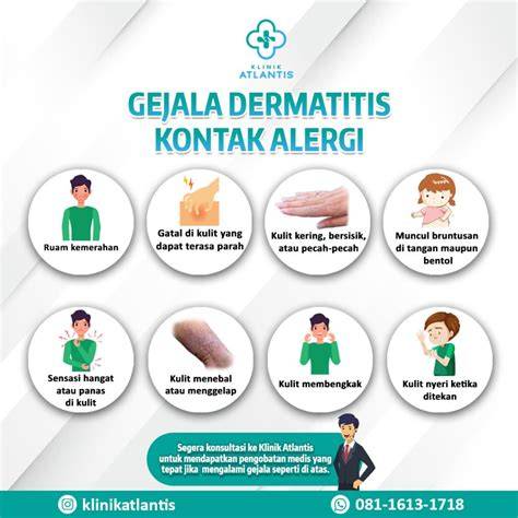 Gejala Alergi