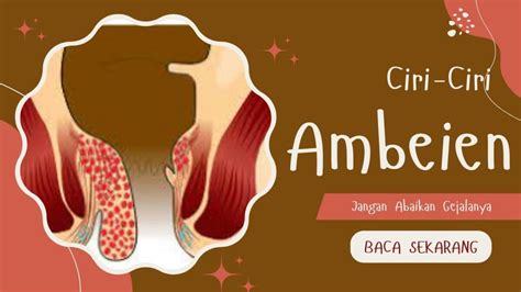 Gambar Gejala Ambien