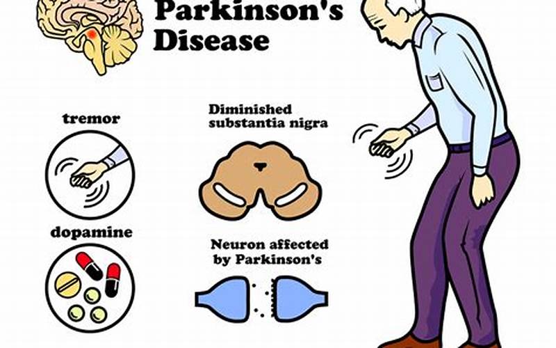Gelly Strain Parkinson'S Disease