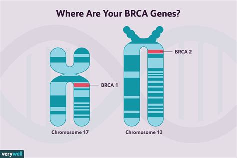 Genetic Predisposition (BRCA Mutations)