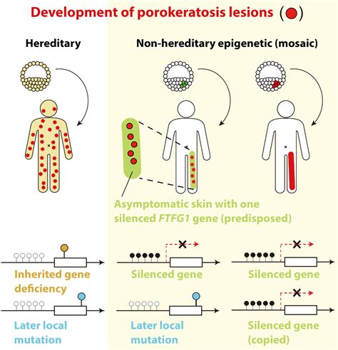 Genetic Predisposition and Skin Aging