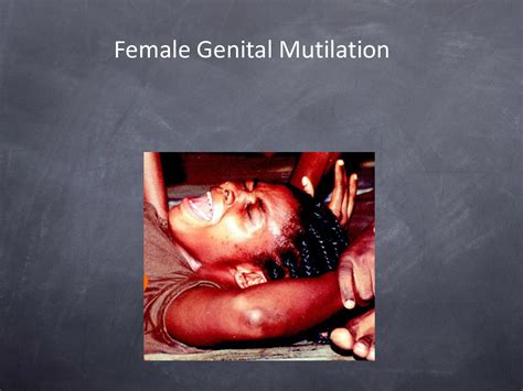 Genital