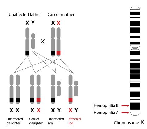 Genotip Hemofilia: Penyebab, Gejala dan Pengobatan