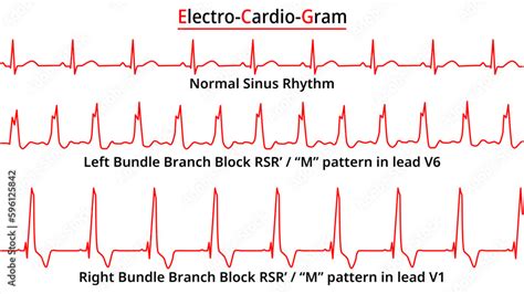 Getting the Rhythm Right