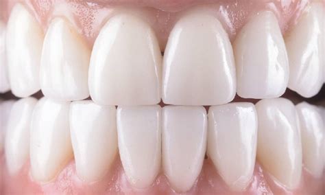 Gigi Sehat & Gusi Kuat: Tips Rumah.