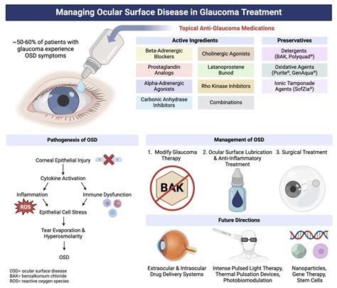 Glaucoma Management